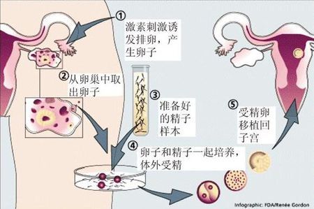 关于私人孕妈供卵代怀服务选性别